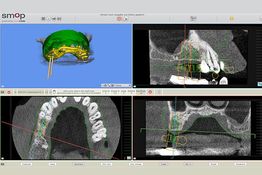 Moderne Technik in der Praxis für Mund-, Kiefer- und Gesichtschirurgie